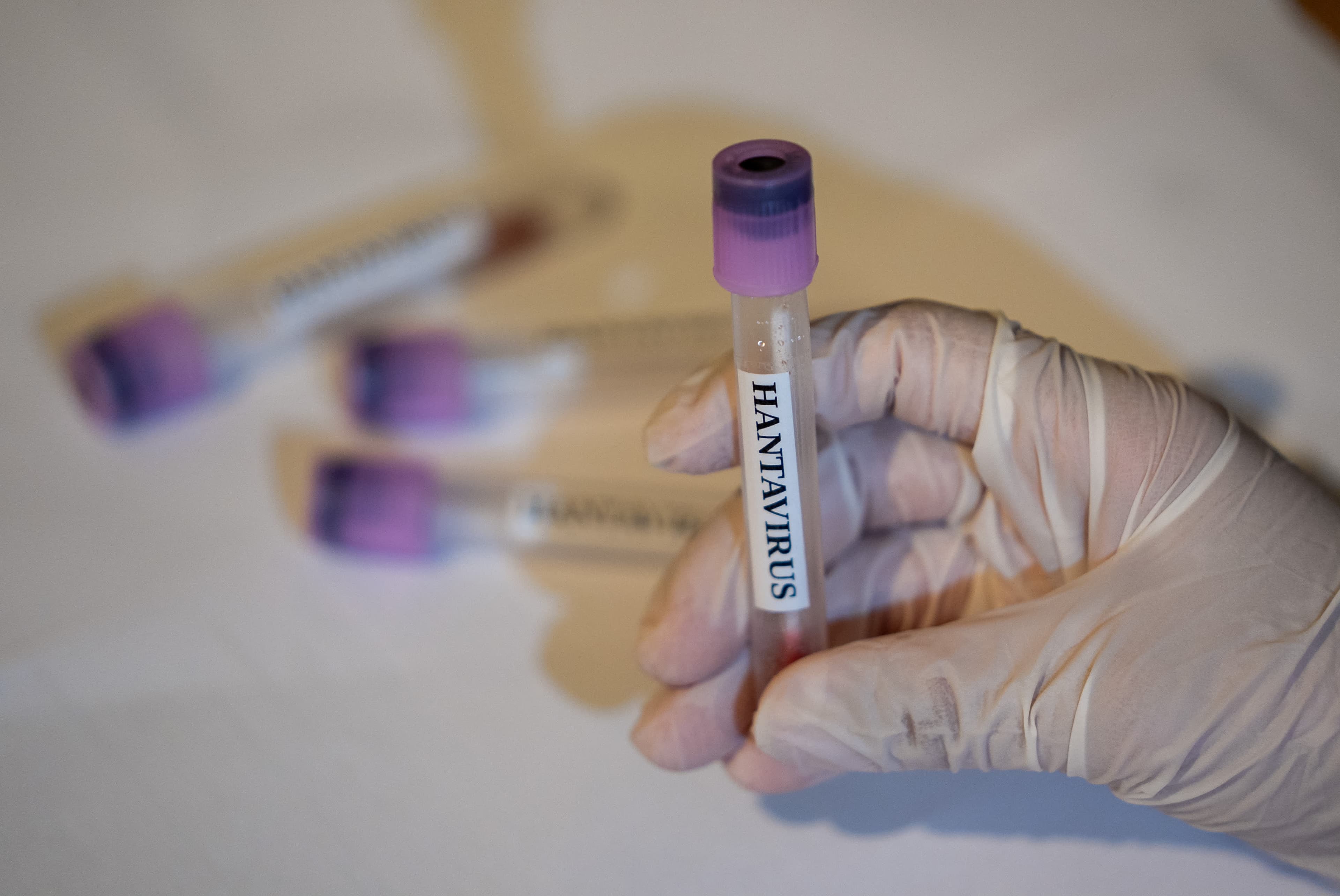 CDC Monitoring 41 Hantavirus Cases; Public Risk Remains Low