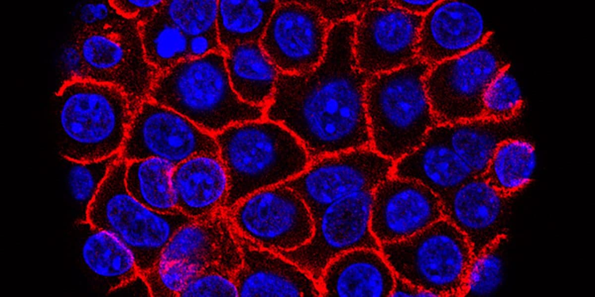 Breakthrough Pancreatic Cancer Drug Doubles Survival Time