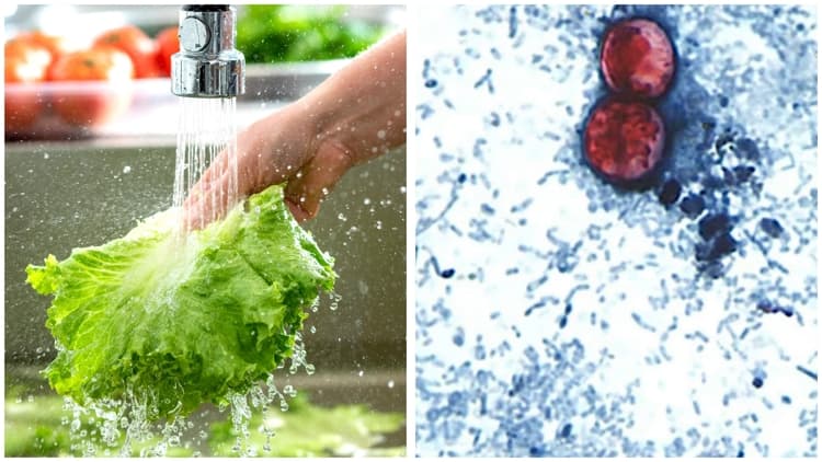 NC Battles Cyclosporiasis Outbreak: 300+ Cases Reported
