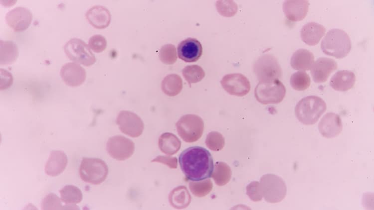 Cabarrus County Health Officials Investigate Cyclosporiasis Case