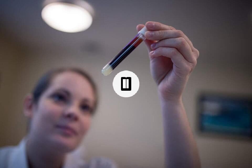 Blood Tests Transform Alzheimer's Detection, Raising Accuracy Questions