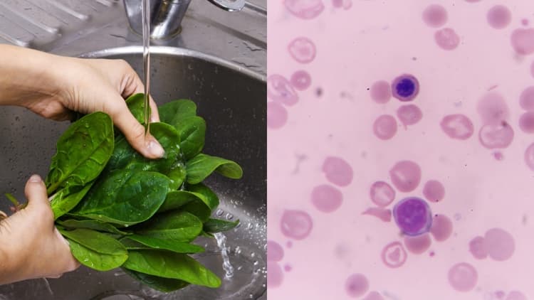 NC Cyclosporiasis Outbreak Hits 718 Cases; Source Remains Unknown