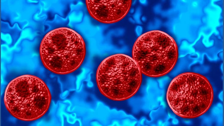 First Cyclosporiasis Case Detected in Rowan County